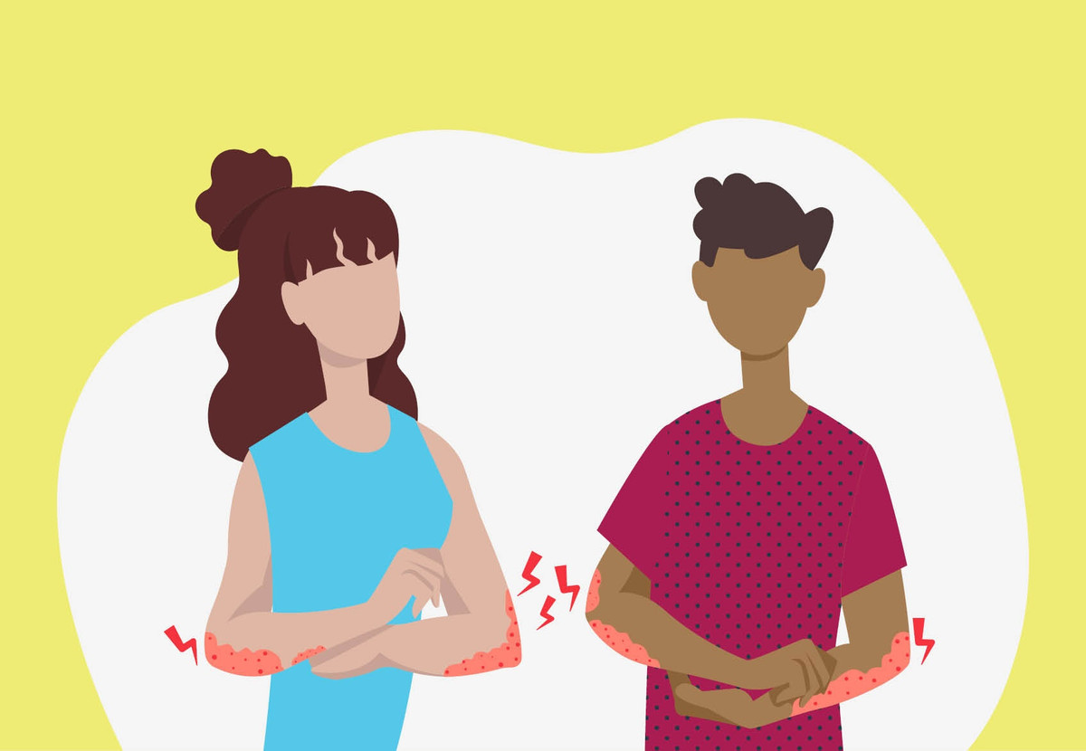 Cach giam ngua do do mo hoi