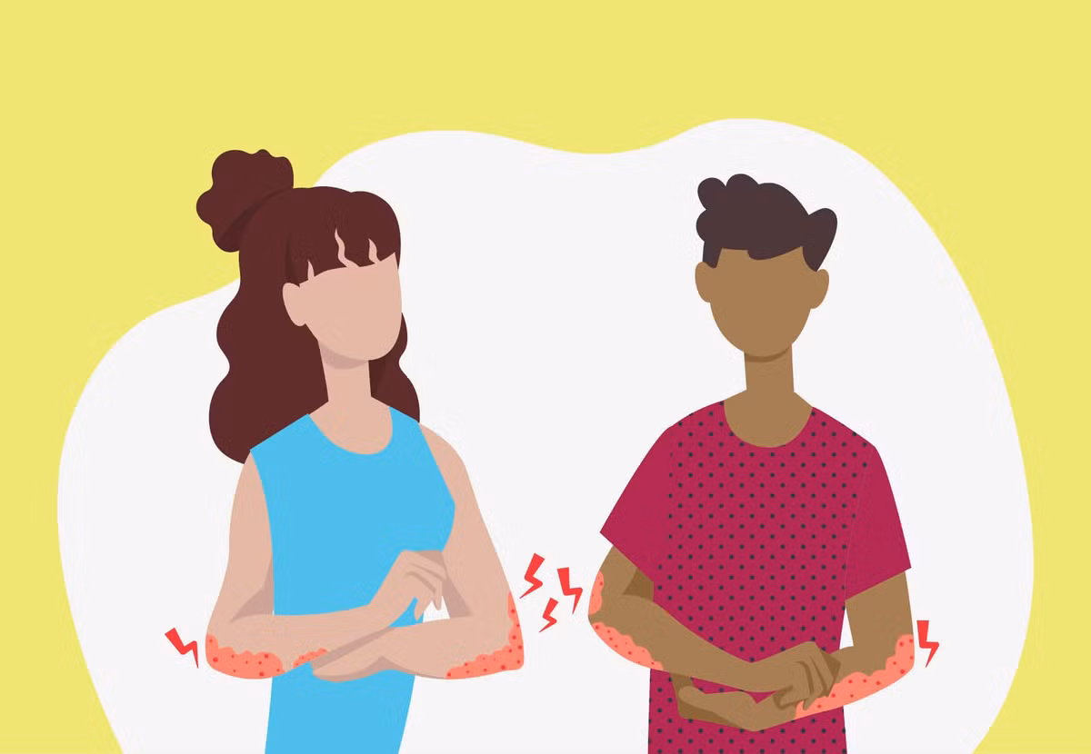 Cach giam ngua do do mo hoi