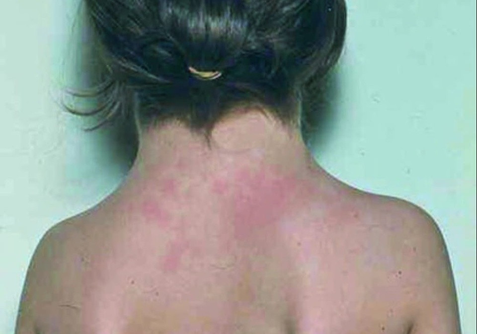 Be gai o Nghe An mac hoi chung Turner