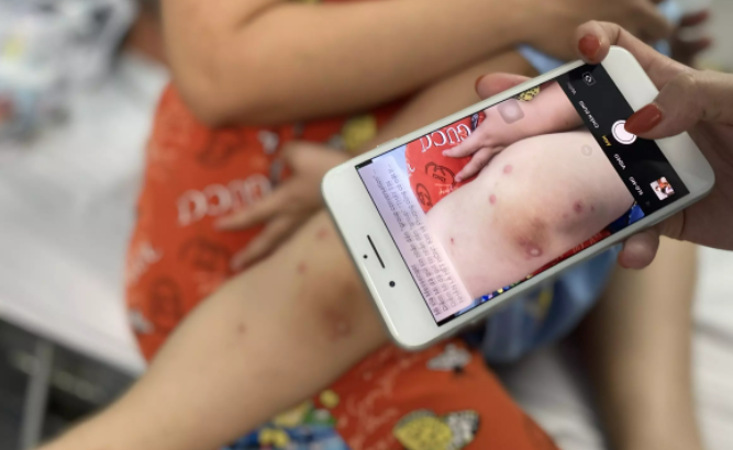 Benh tay chan mieng o TP.HCM tang bao dong