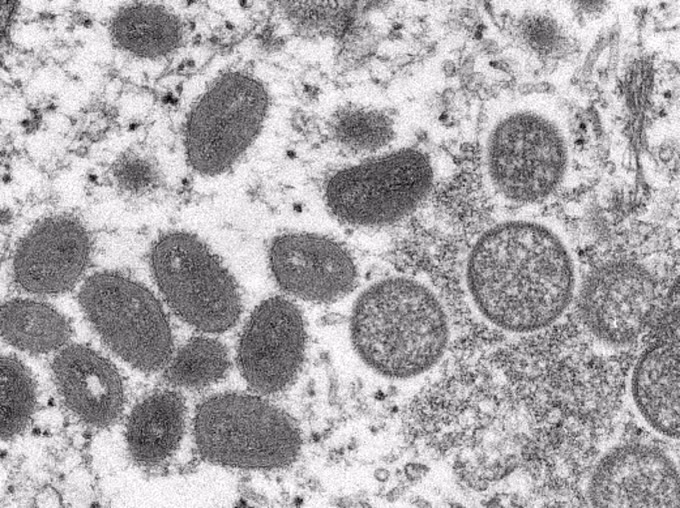 Benh dau mua khi lay lan qua nhung duong nao?-Hinh-2