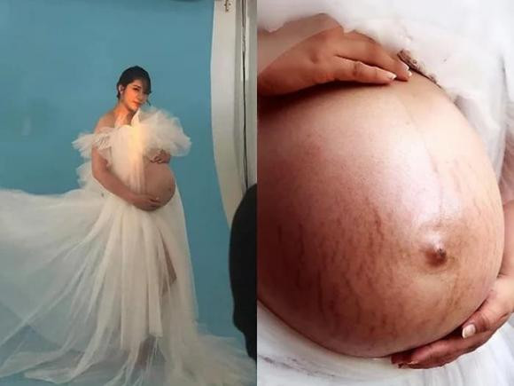 Còn nhớ khi mang thai đôi vào năm 2020, Hoa hậu Đại dương Đặng Thu Thảo bị những vết rạn đỏ chẳng chịt do bụng bầu quá to khiến ai nhìn cũng xót xa. Từ sau khi sinh con xong, cô cũng không đăng ảnh khoe dáng với trang phục ít vải, nhất là không để lộ vùng bụng. Tuy nhiên, nàng Hậu đã phá lệ khi chia sẻ ảnh diện nội y đen với ba vòng hoàn hảo chắc nịch. Đặc biệt phần bụng phẳng lì với các cơ cuồn cuộn và không hề có bất kì vết tích rạn da nào khiến dân tình phải xuýt xoa. Chị gái Đặng Thu Thảo cho biết đây là lần đầu cô khoe thân với góc cận như thế. Thành quả tập luyện chăm chỉ và làm đẹp đúng cách đã giúp nàng Hậu lột xác hoàn toàn, thậm chí đẹp hơn xưa. 