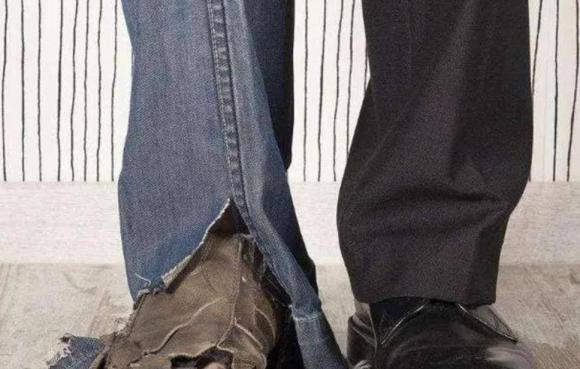 Nguoi co 3 dau vet nay co le tam hon ac doc-Hinh-3