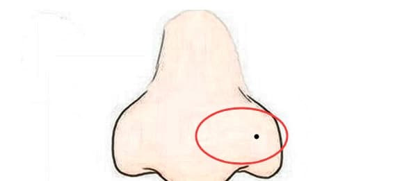 Mat co 4 not ruoi nay se thu hut ke xau, huy van may