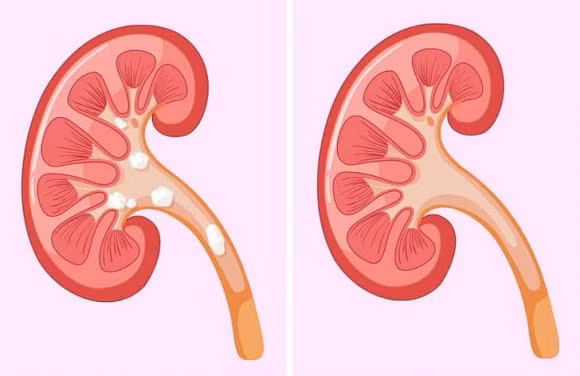 6 loi ich khi an trai cay yeu thich ma it nguoi biet-Hinh-4