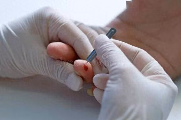 Nguoi tieu duong co the song tren 80 tuoi thuong co dac diem nay