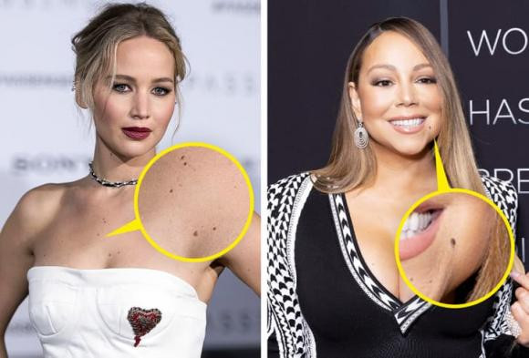 Not ruoi den tu dau, tai sao viec phan biet chung lai quan trong?