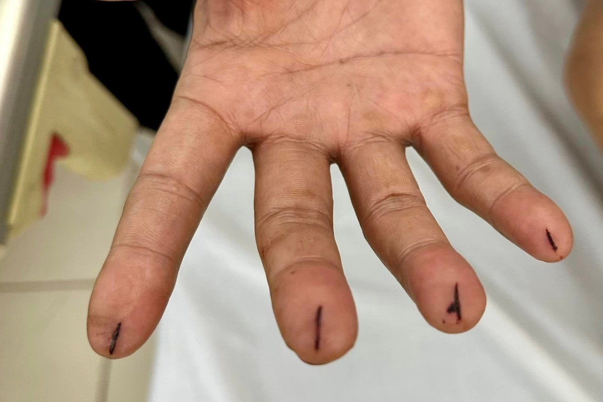 Phan biet dot tu va dot quy-Hinh-2