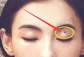 Tren mat co 3 not ruoi anh huong den phu quy, ca doi ngheo kho-Hinh-3