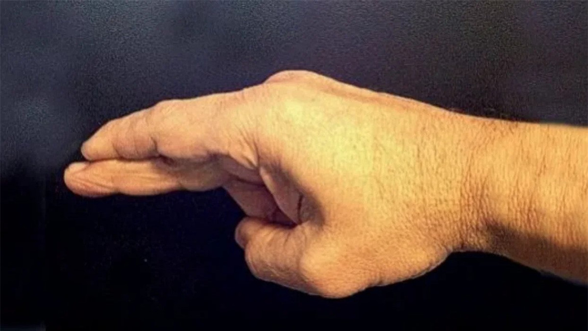 Điểm mạch có cơ sở lịch sử. Trong "Võ Bị Chí", một cuốn sách tiếng Nhật cổ xưa viết về võ thuật có nhắc tới tuyệt kỹ chỉ một đòn cũng gây hại khôn lường cho đối phương, theo trang mạng io9.com. Thế nhưng các chi tiết cụ thể hơn, bao gồm việc kỹ năng này đánh vào vị trí nào trên cơ thể, và tác động của nó là như thế nào vẫn còn là bí ẩn.