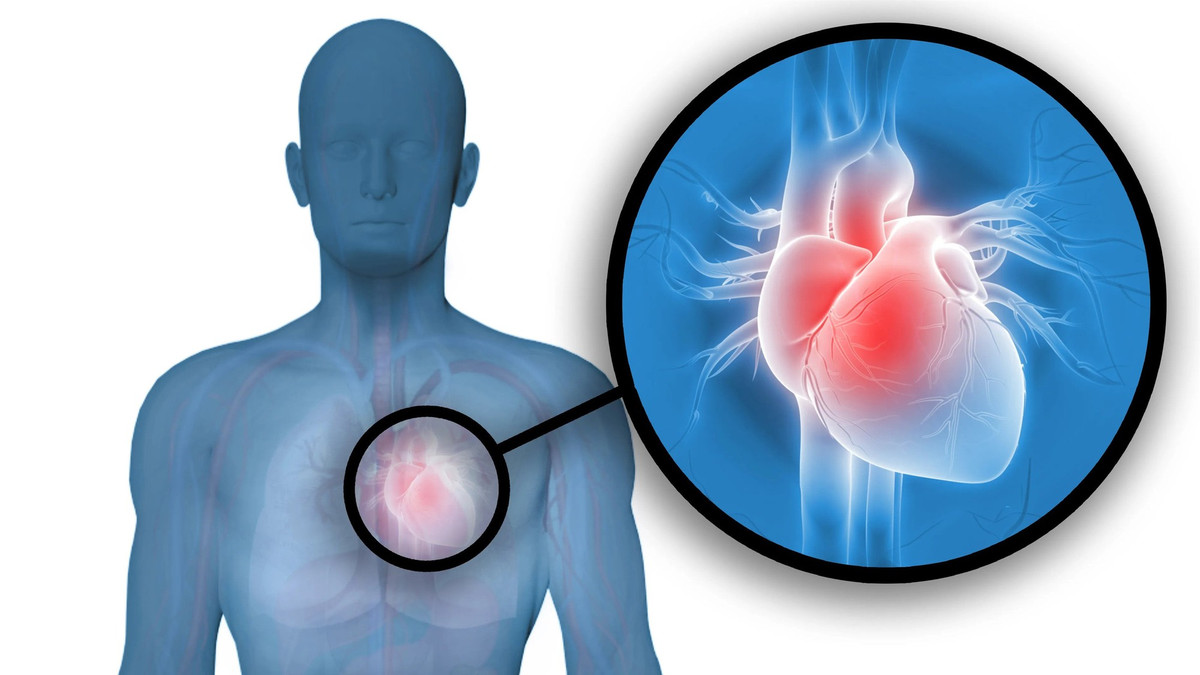 "Một đòn chết ngay" có thể liên quan tới chứng bệnh commotio cordis (chấn động tim mạch). Commotio cordis là cái chết tức thời gây ra bởi một đòn đánh vào ngực làm rối loạn nhịp tim. Tim của người bị tác động không bị tổn hại, nhưng cú đánh làm gián đoạn nhịp tim trong khoảng thời gian đủ gây ra cái chết.