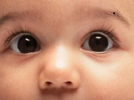 Tre co not ruoi 3 vi tri nay tuong lai sang, phu quy hon nguoi-Hinh-2