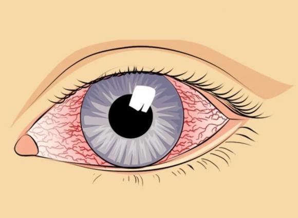 6 cach tu nhien lam sach phoi tai nha, khong ton mot xu-Hinh-2