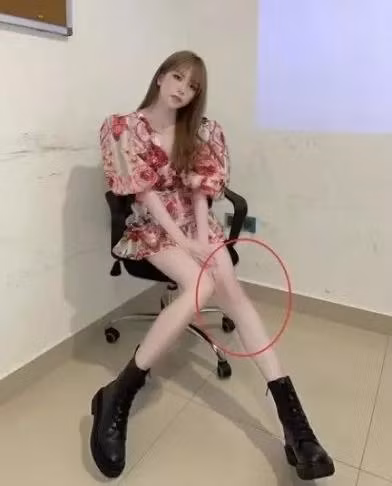 Thieu Bao Tram sut can, sap mat hinh the trong mo?-Hinh-12