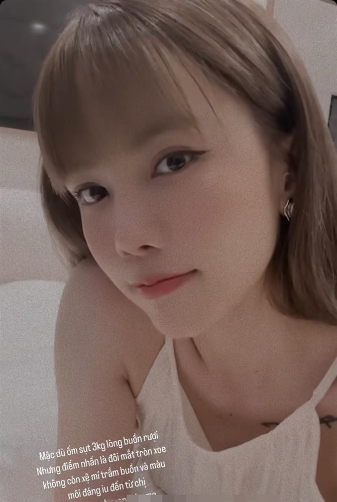 Thieu Bao Tram sut can, sap mat hinh the trong mo?-Hinh-2