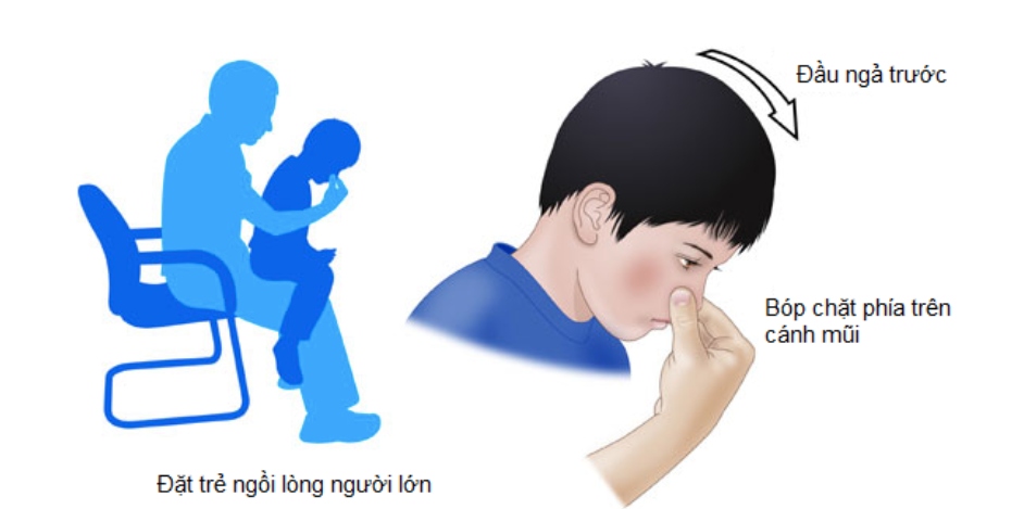 Nhieu nguoi chay mau cam mua dong, dau hieu nao nen di vien ngay?