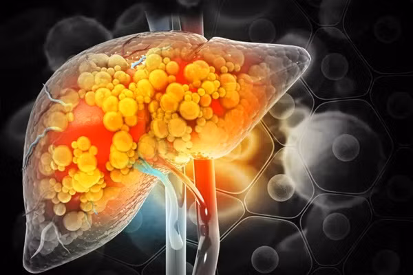 8 dau hieu cho thay doc to tich tu qua nhieu trong gan