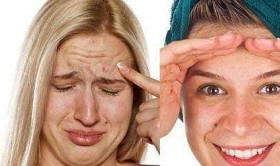 Nhung not ruoi nay tot nhat nen tay di-Hinh-2