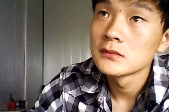 Nhung not ruoi nay tot nhat nen tay di-Hinh-6