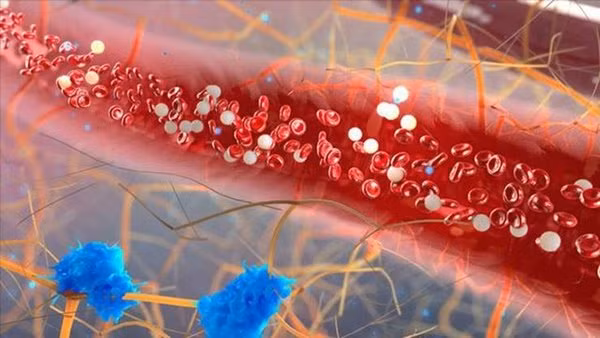 4 can benh gay dau tuc nguc can phai canh giac-Hinh-9