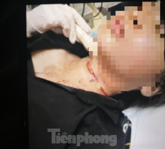 Canh sat thong tin vu co gai tre bao an bi cat co, cuop tai san o Binh Duong