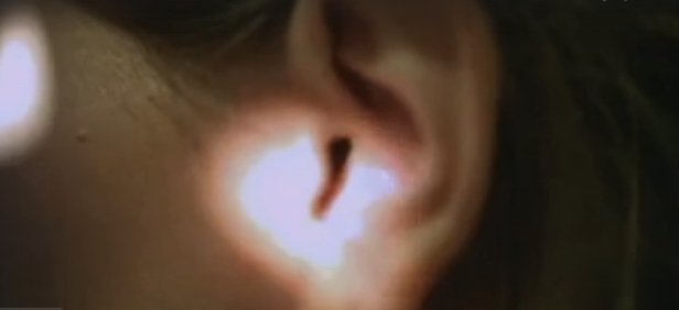  Các bác sĩ đang tiến hành soi bên trong tai bệnh nhân... 