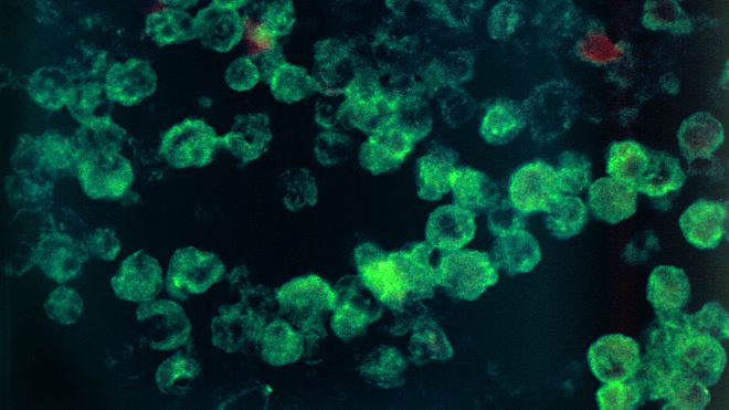 Amip ăn não có tên Naegleria fowleri thường cư trú trong sông, suối.
