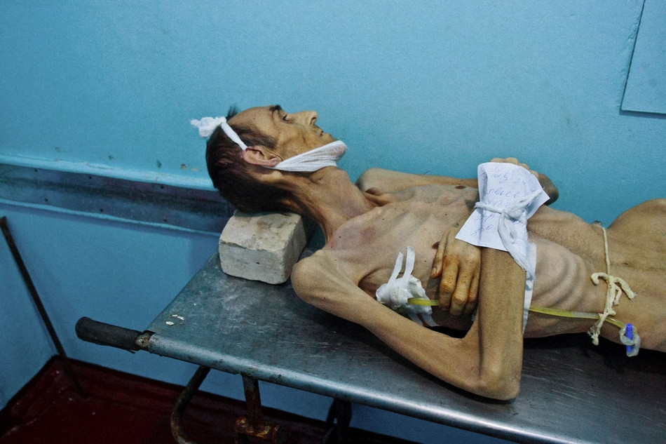 Dịch lao là một trong những vấn đề nghiêm trọng tại Ukraina.