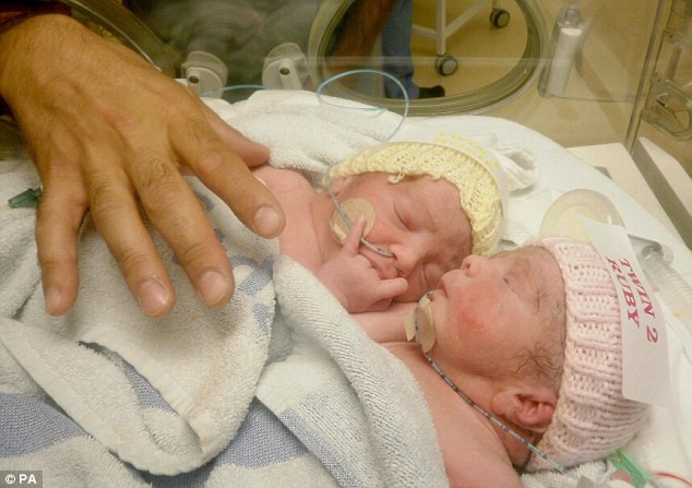 Ca phẫu thuật tách đôi cặp song sinh dính liền bẩm sinh này kéo dài 5 giờ và dưới sự trợ giúp của 15 bác sĩ, y tá.