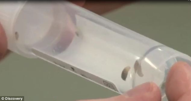 Đã có tới 14 con dòi ký sinh dưới da Catherine, chúng có thể phát triển dài hơn 1 cm nếu không được lấy ra sớm.