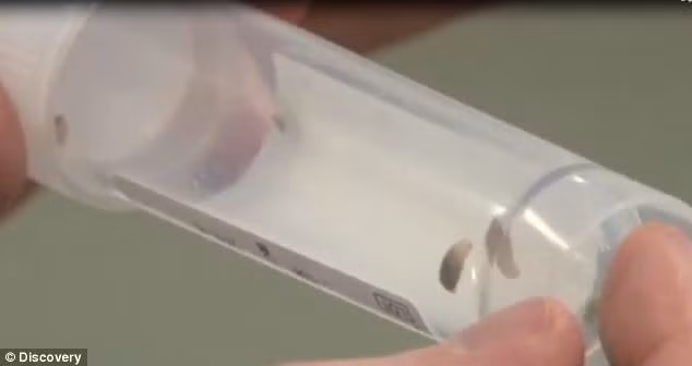 Đã có tới 14 con dòi ký sinh dưới da Catherine, chúng có thể phát triển dài hơn 1 cm nếu không được lấy ra sớm.