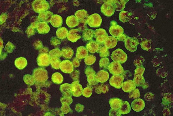 Naegleria fowleri hay còn gọi là amip ăn não là một loại sinh vật đơn bào thuộc nhóm excavata sinh sống tự do, thường được tìm thấy trong các khu vực nước ngọt ấm, chẳng hạn như ao, hồ, sông, suối nước nóng. Nó cũng được tìm thấy trong đất, gần khu nước thải ấm áp của các nhà máy công nghiệp, và bể bơi không xử lý bằng clo trong một giai đoạn trùng roi amip hoặc tạm thời.