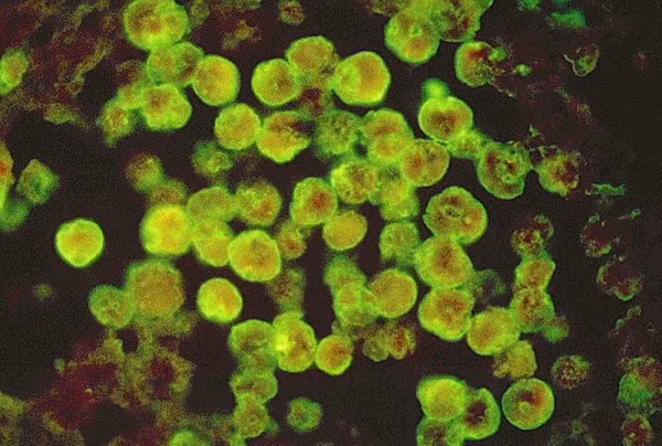 Naegleria fowleri hay còn gọi là amip ăn não là một loại sinh vật đơn bào thuộc nhóm excavata sinh sống tự do, thường được tìm thấy trong các khu vực nước ngọt ấm, chẳng hạn như ao, hồ, sông, suối nước nóng. Nó cũng được tìm thấy trong đất, gần khu nước thải ấm áp của các nhà máy công nghiệp, và bể bơi không xử lý bằng clo trong một giai đoạn trùng roi amip hoặc tạm thời.