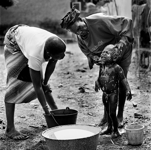 Những đứa trẻ cần được vệ sinh sạch sẽ trước và sau nghi lễ đau đớn này.