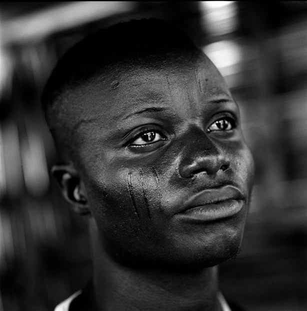 Vết sẹo được xem là dấu hiệu đặc biệt trên khuôn mặt một người đàn ông trưởng thành.