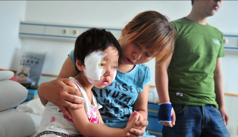 Các bác sĩ nói rằng tai nạn có thể khiến khuôn mặt bé bị biến dạng.