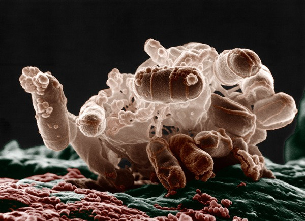 E. coli là viết tắt của thuật ngữ Escherichia Coli dùng để chỉ một nhóm vi khuẩn (bacteria) sống trong đường tiêu hóa (ruột) của con người và động vật. Chúng ta có thể bị nhiễm E. coli qua tiếp xúc hay phơi nhiễm với phân người và phân động vật, kể cả gia cầm. “Tiếp xúc” ở đây có nghĩa là uống nước hay ăn thức ăn bị nhiễm phân.
