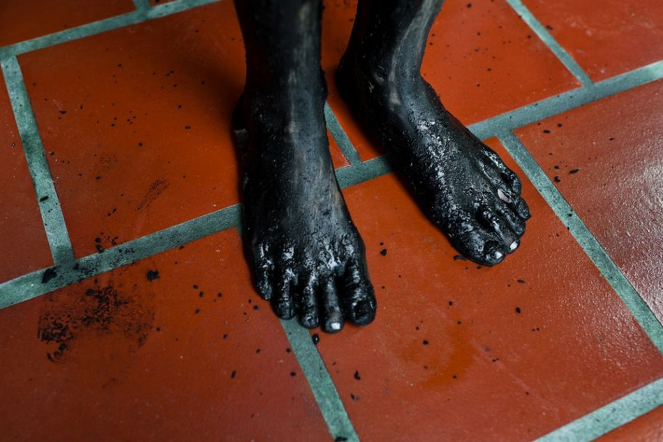 Thân thể cô bé Diana R... được bao phủ bùn đen từ đầu đến chân.