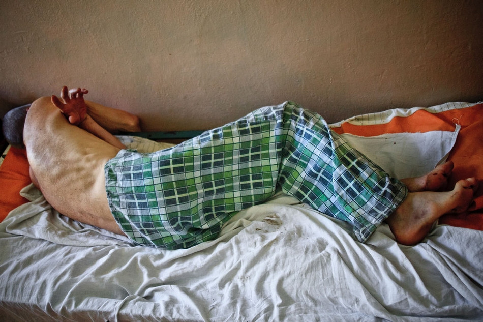 Thân thể gầy còm của một bệnh nhân nằm co quắp trên giường.