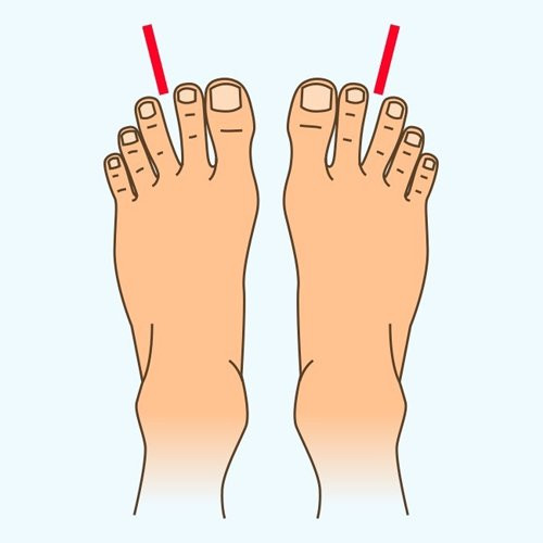 Nhìn độ dài ngón chân biết ngay vận mệnh tương lai giàu có hay bần hàn - Hình 2 Nhin do dai ngon chan biet ngay van menh tuong lai giau co hay ban han-Hinh-2