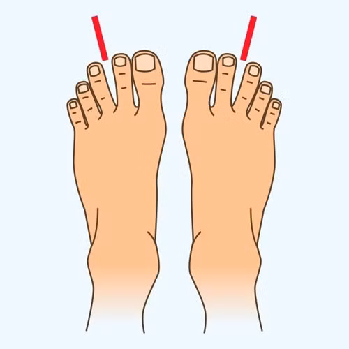 Nhin do dai ngon chan biet ngay van menh tuong lai giau co hay ban han-Hinh-2