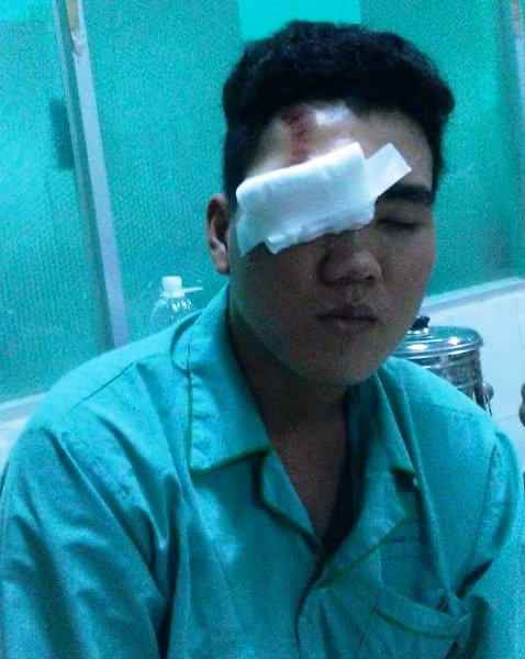 Nạn nhân Lê Thanh Hải có khả năng bị mù mắt phải, hiện mắt trái cũng bị ảnh hưởng. Ảnh: Phan Cường