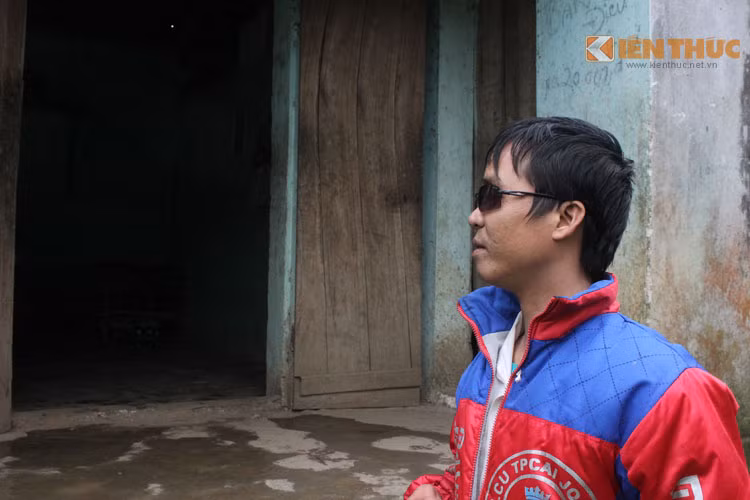 Đôi mắt của anh Quỵnh vĩnh viễn không còn nhìn thấy mặt trời.