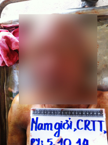 Thi thể nạn nhân.