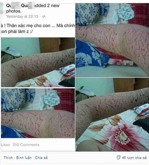 Ảnh khiến người xem phải rùng mình.