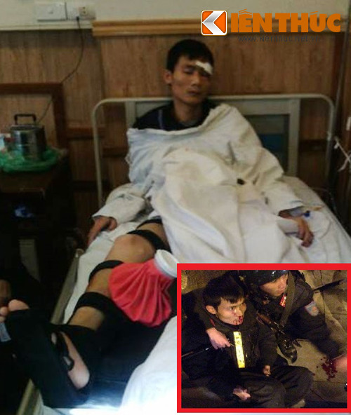 Sau khi bị nhóm thanh niên lao xe máy, chiến sĩ Nghĩa bị chấn thương nặng vùng đầu, gãy chân (Ảnh to). (Ảnh khoanh đỏ: Hình ảnh chiến sĩ Nghĩa bị trọng thương, chảy máu mũi vì nhóm đối tượng đâm xe vào người trước đó).