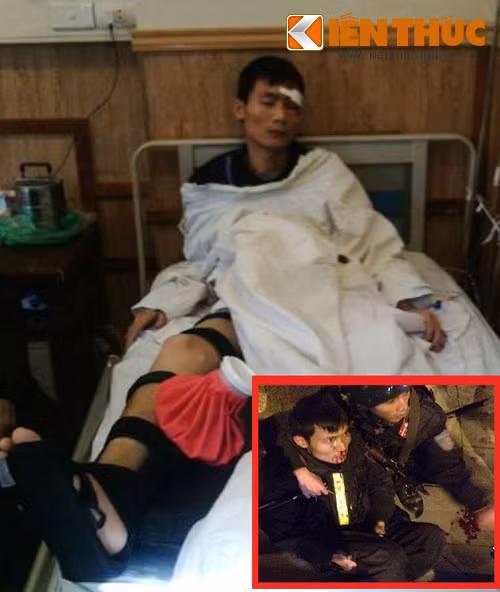 Sau khi bị nhóm thanh niên lao xe máy, chiến sĩ Nghĩa bị chấn thương nặng vùng đầu, gãy chân (Ảnh to). (Ảnh khoanh đỏ: Hình ảnh chiến sĩ Nghĩa bị trọng thương, chảy máu mũi vì nhóm đối tượng đâm xe vào người trước đó).