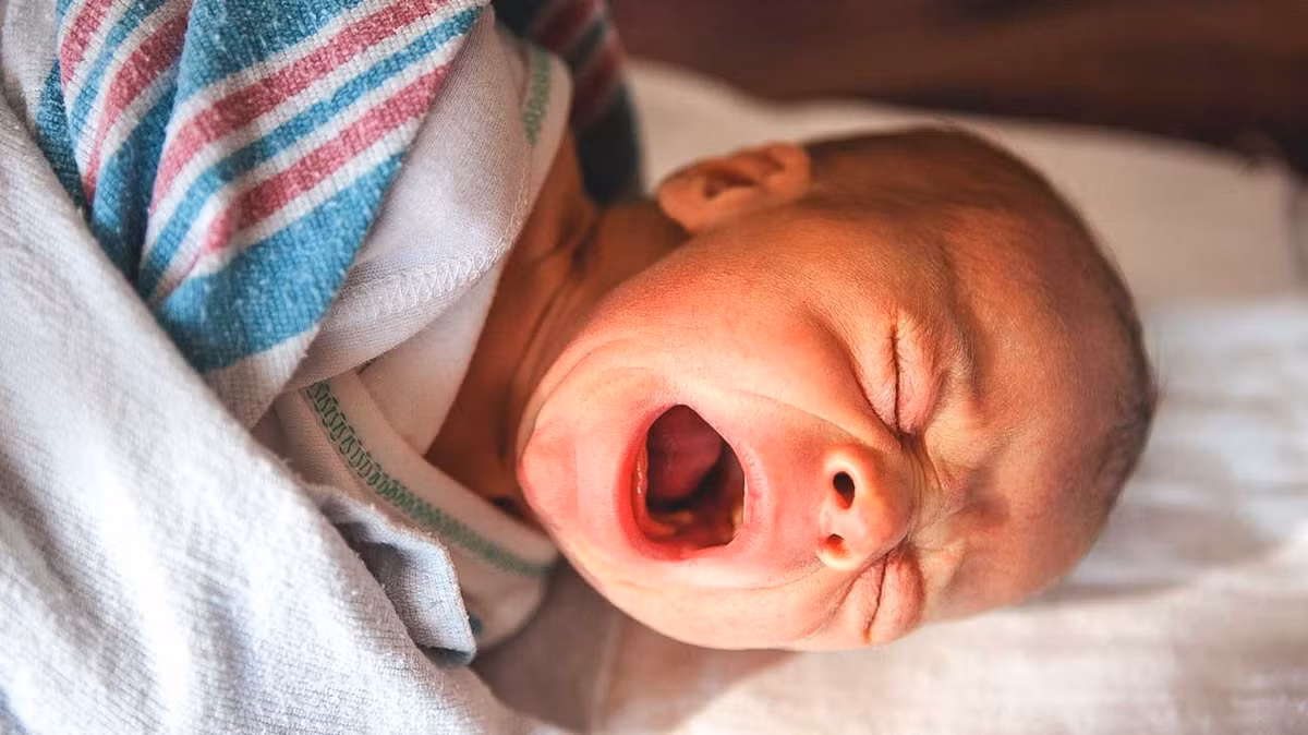 Nhung benh ngoai da thuong gap o tre-Hinh-3