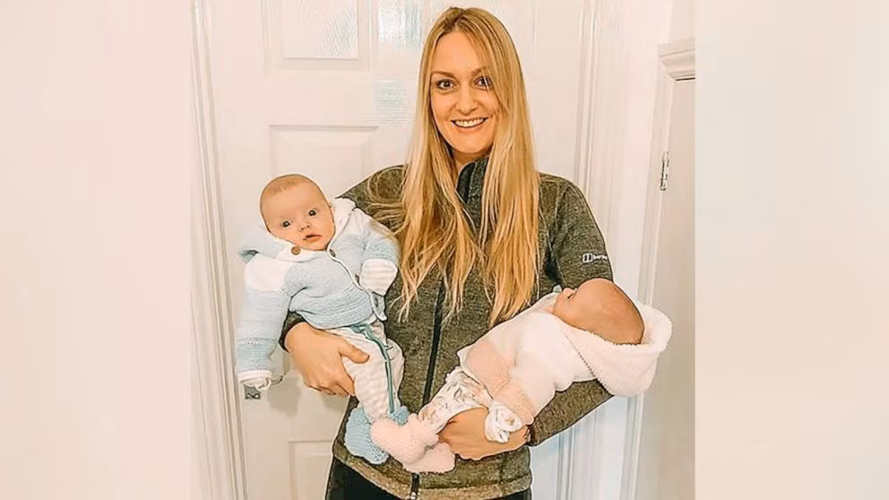 Cap song sinh hiem gap, duoc menh danh la ‘sieu thai’