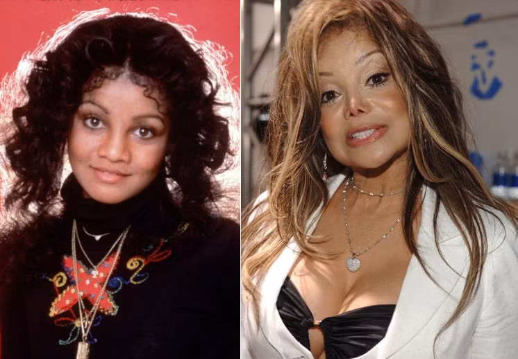 La Toya Jackson là minh chứng hùng hồn, phẫu thuật thẩm mỹ sẽ phá hủy vẻ đẹp cơ thể đặc biệt khi bạn già đi. Hình ảnh tươi tắn tự nhiên khi còn là một thành viên nhóm nhạc anh em nhà Jackson đã được La Toya thay thế bởi khuôn mặt được đập đi làm lại hoàn toàn. Qua năm tháng, càng có tuổi, “mặt tiền” của La Toya càng xập xệ thấy rõ.
